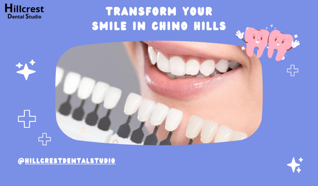 Teeth Veneers In chino hills