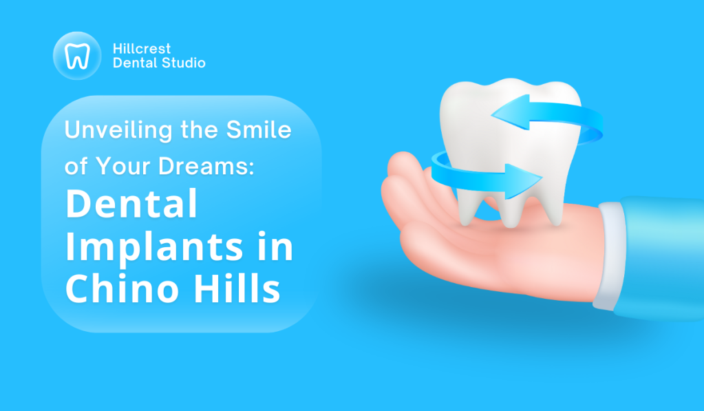 dental implants chino hills